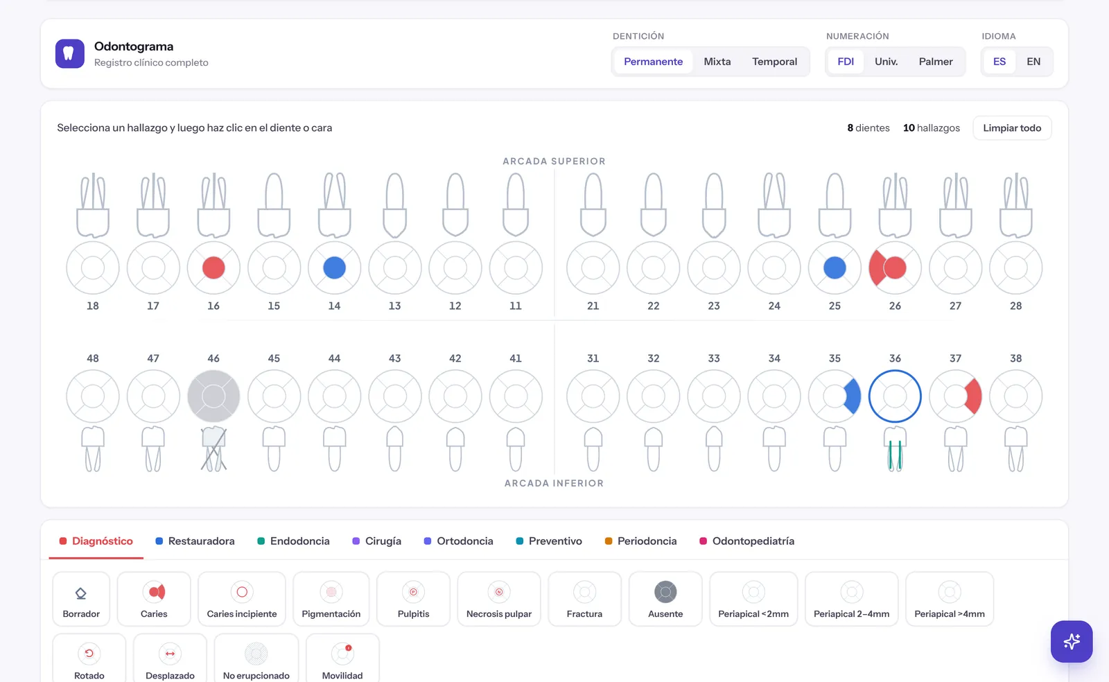 Odontograma digital del software dental con hallazgos por diente y por cara
